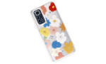 Newface Xiaomi Redmi Note 11S Kılıf Lucky Silikon - Lucky 8